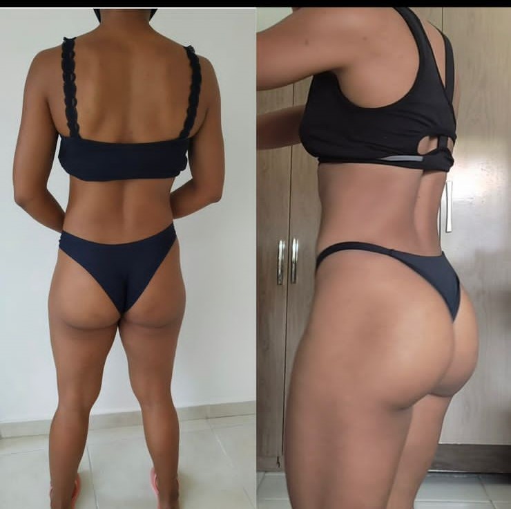 Antes e depois de aluna da Natflix Fitness