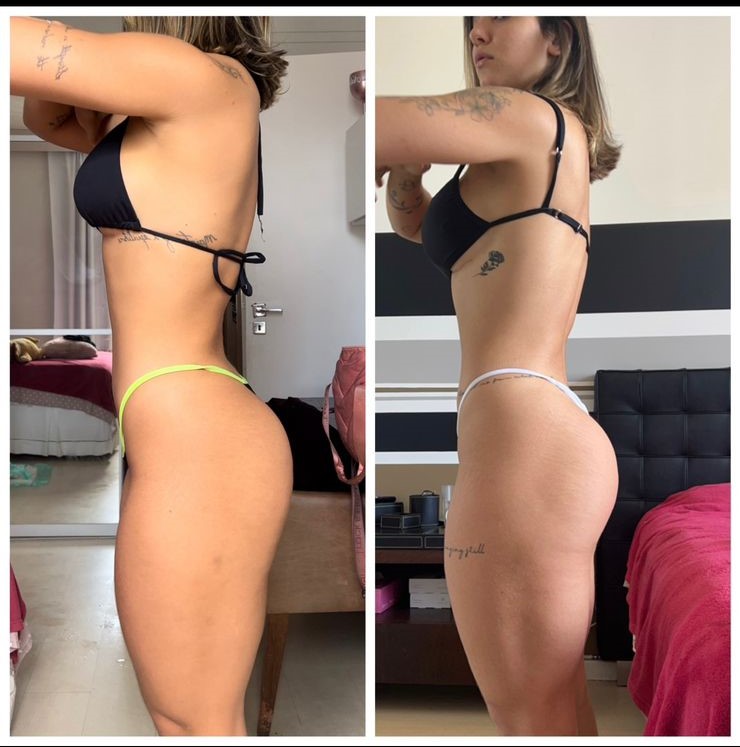 Antes e depois de aluna da Natflix Fitness